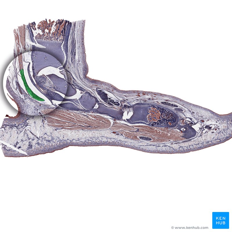 Achilles tendon - histological slide