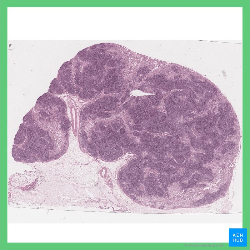 Lymph node - histological slide