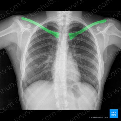 Clavícula (Clavicula); Imagen: 