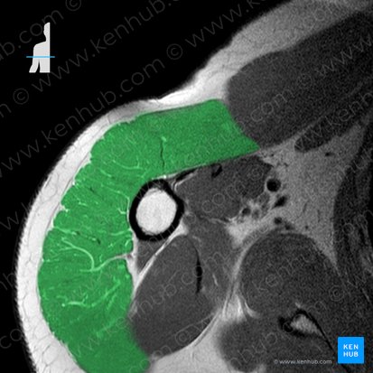 Deltoid muscle (Musculus deltoideus); Image: 