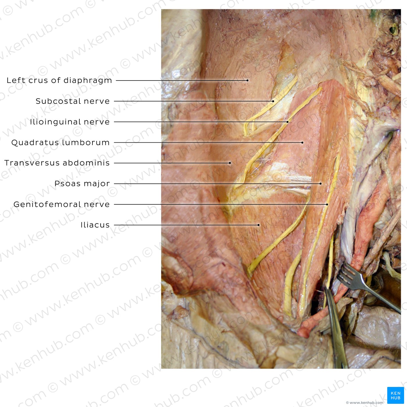 Posterior abdominal wall: Cadaveric image