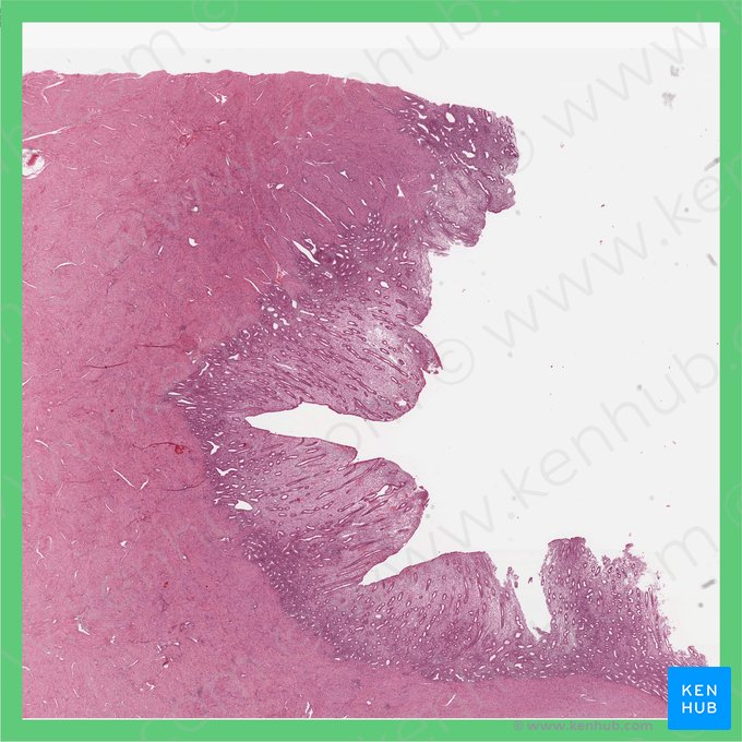 Phase folliculaire tardive (Phasis proliferativa tarda (Uterus)); Image : 
