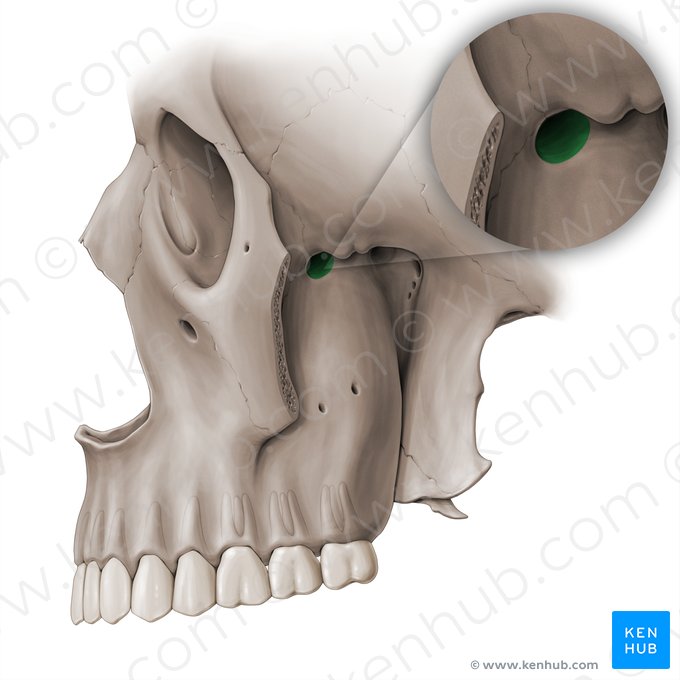 Fissura orbital inferior (Fissura orbitalis inferior); Imagem: Paul Kim