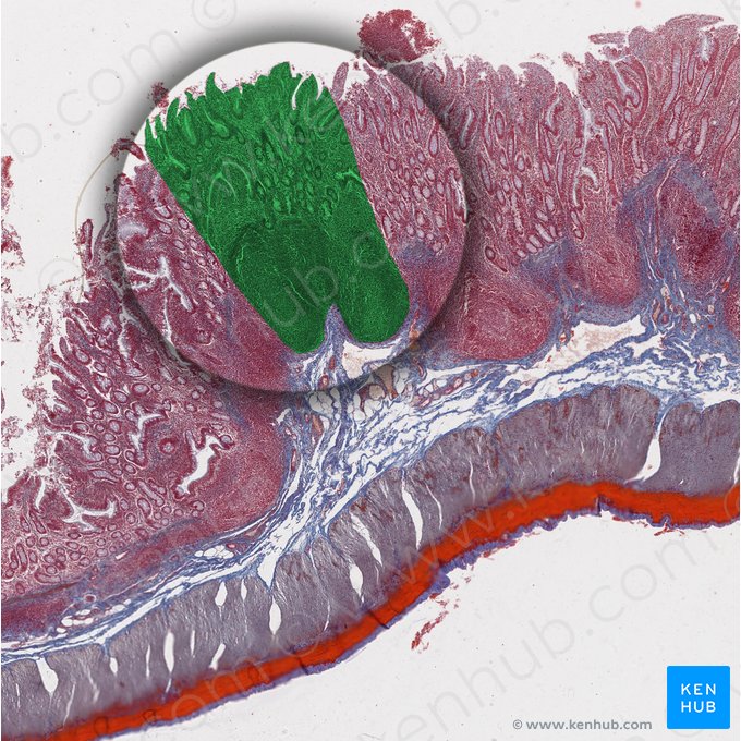 Mucosa (Tunica mucosa); Imagen: 