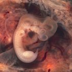 Embryology: 3rd week of development
