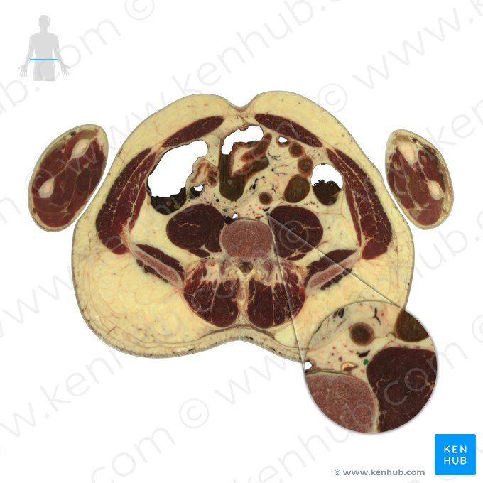 Ureter; Imagem: National Library of Medicine