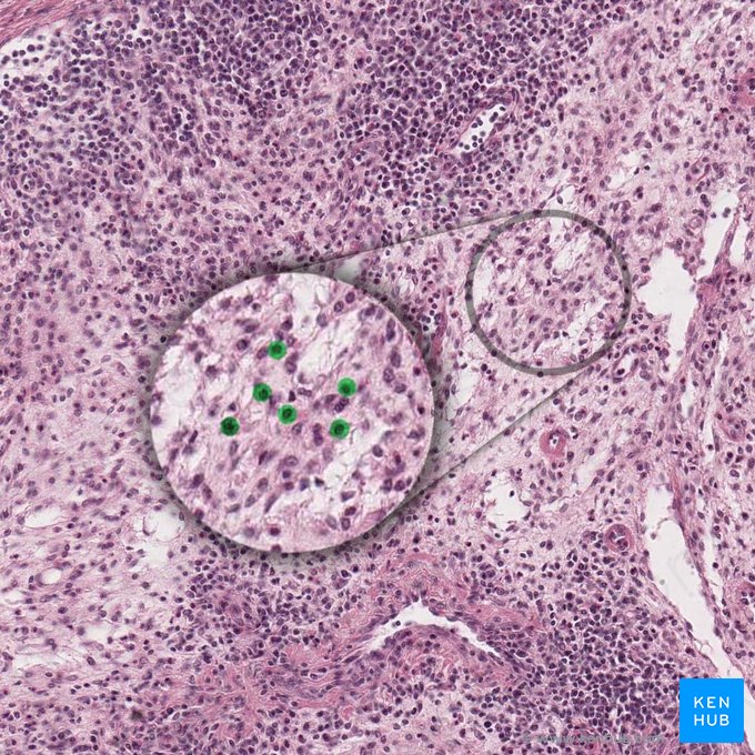 Reticular cells (Cellula reticularis); Image: 