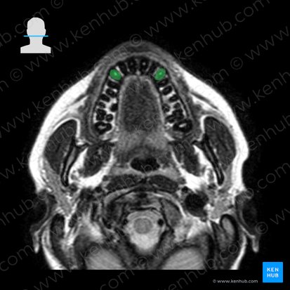 Canine tooth (Dens caninus); Image: 