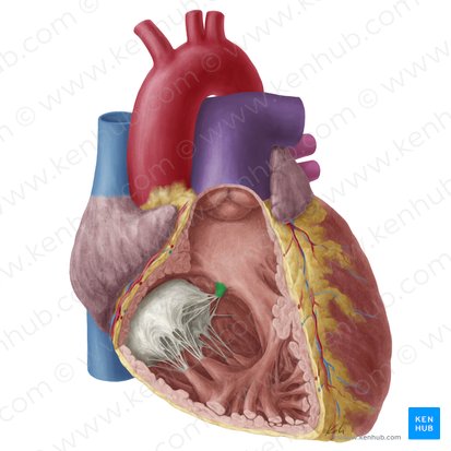 Septal papillary muscle of right ventricle (Musculus papillaris septalis ventriculi dextri); Image: Yousun Koh