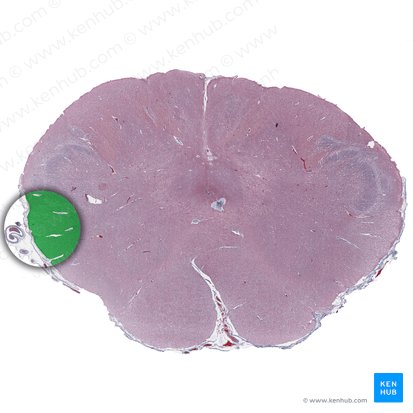 Spinocerebellar tract (Tractus spinocerebellaris); Image: 