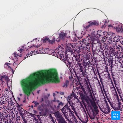 Colonocyte (Colonocytus); Image: 