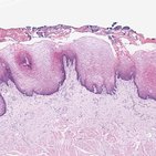 Tongue and epiglottis