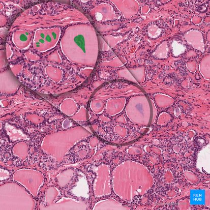 Cristales de oxalato de calcio en el folículo (Crystalla calcium oxylatorum folliculi); Imagen: 