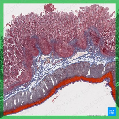 Ileum; Image: 