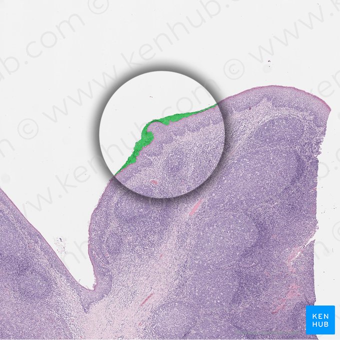 Cápsula (Capsula); Imagen: 