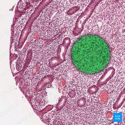 Endometrial Stroma; Image: 