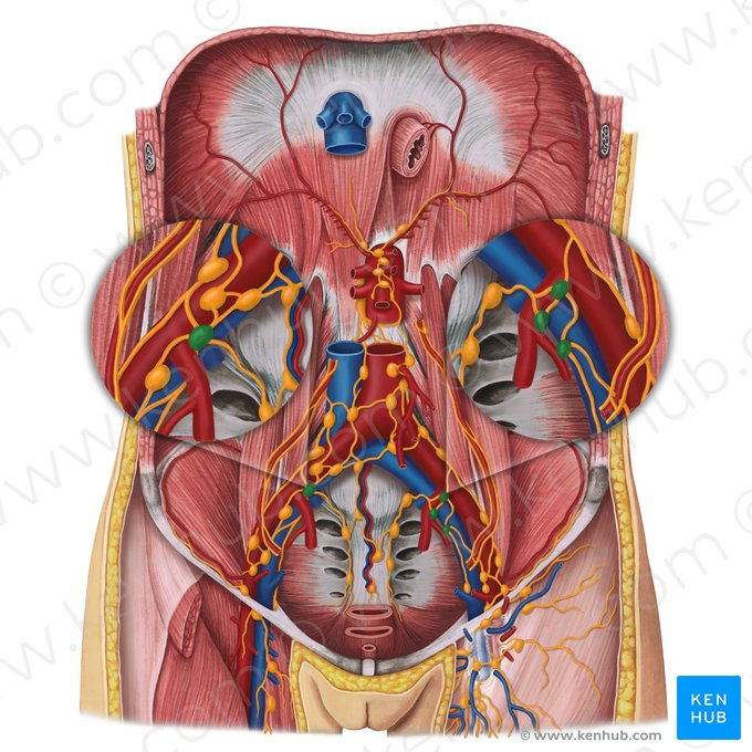 Nodi lymphoidei iliaci interni (Innere Beckenlymphknoten); Bild: Irina Münstermann