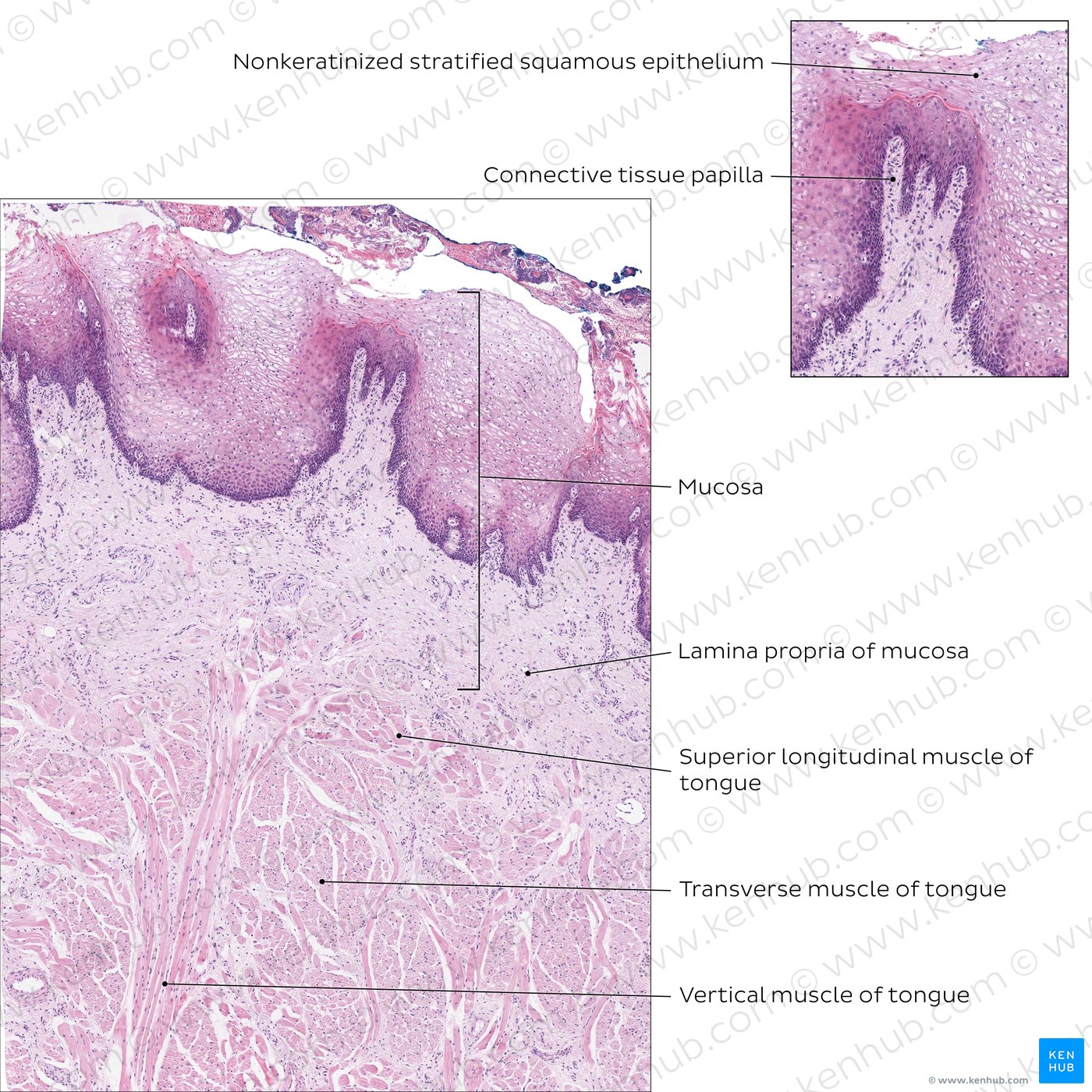 Dorsal surface of tongue in section