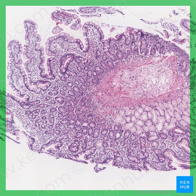 Duodeno (Duodenum); Imagem: 
