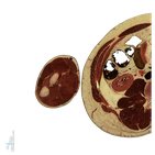 Supinator muscle level