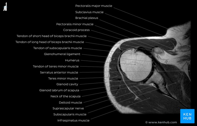 Shoulder MRI PD overview - Glenoid cavity level