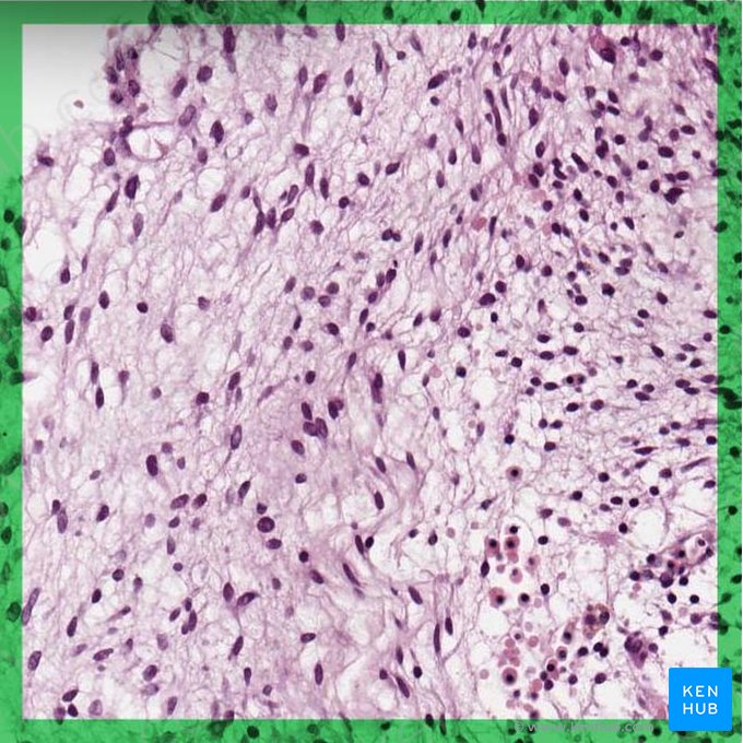 Textus connectivus elasticus (Straffes elastisches Bindegewebe); Bild: 
