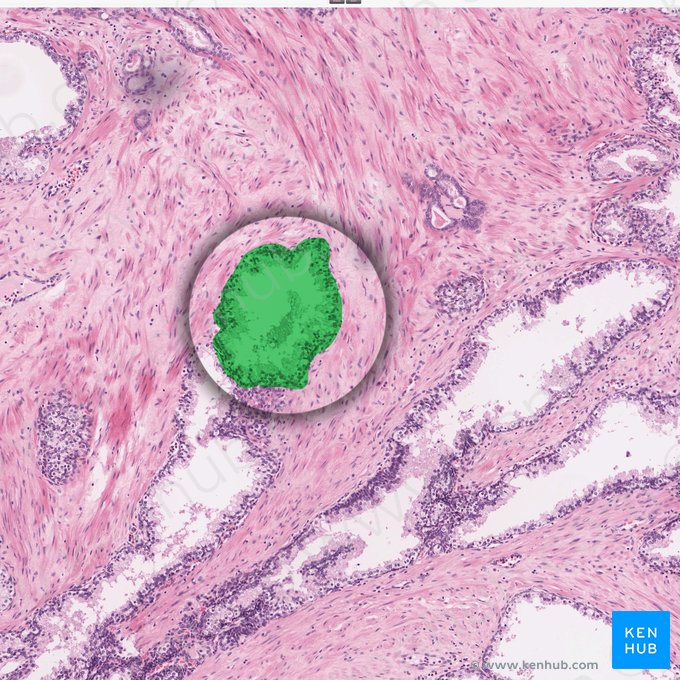 Prostatic acinus; Image: 