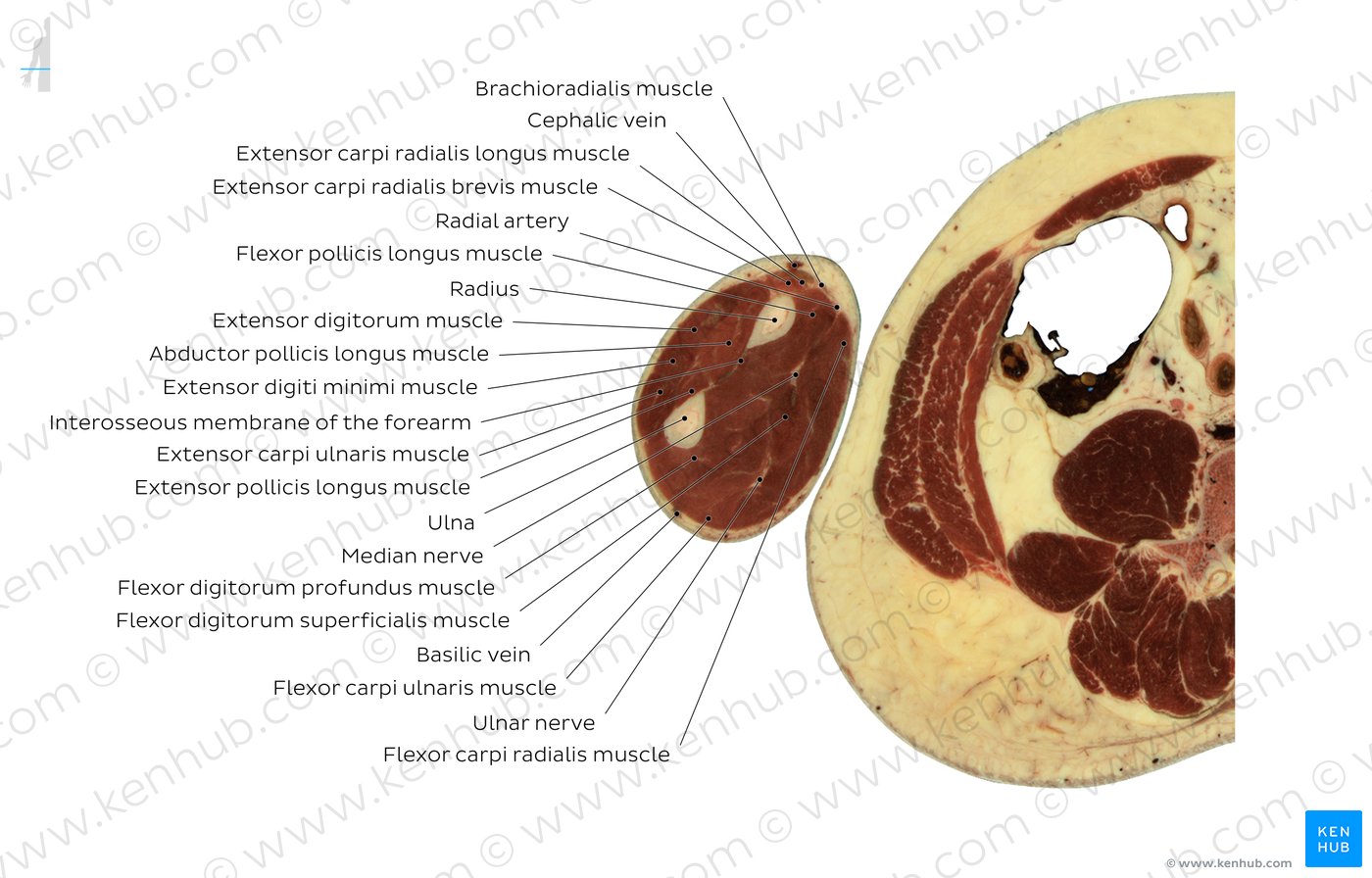 Cross section of the forearm through the flexor carpi ulnaris muscle: Diagram