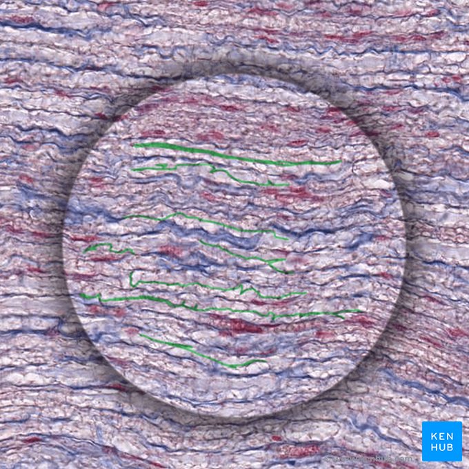 Peripheral myelinated axon/nerve fiber (Axon myelinatum periphericum); Image: 