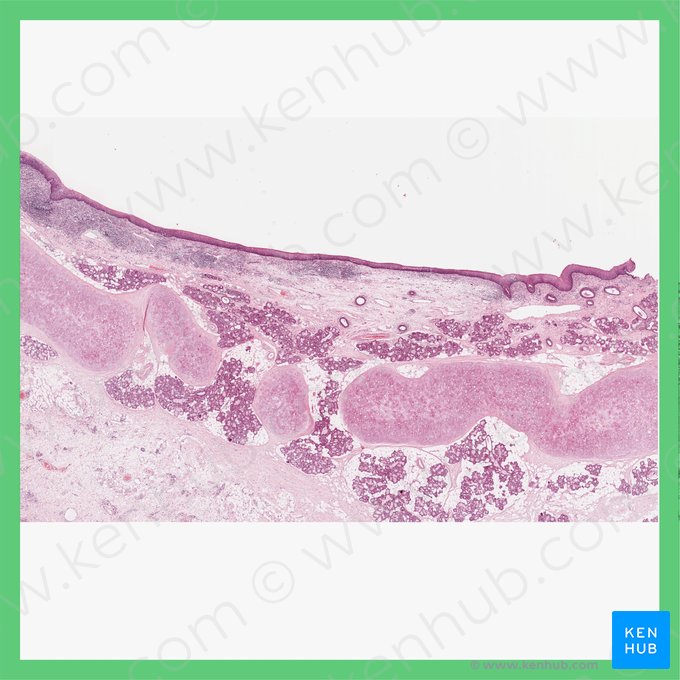 Epiglote (Epiglottis); Imagem: 