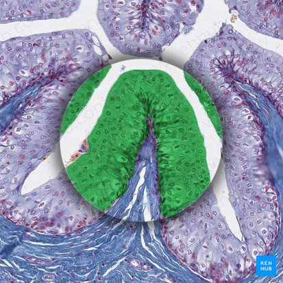 Urotelio (Urothelium); Imagen: 