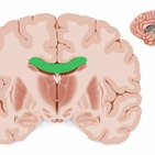 Coronal sections of the brain