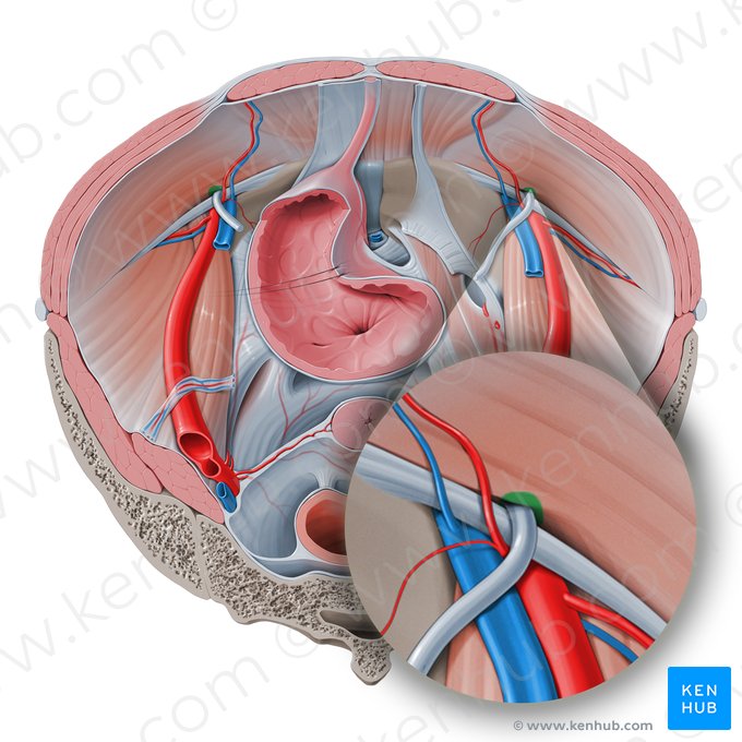 Deep inguinal ring (Anulus inguinalis profundus); Image: Paul Kim