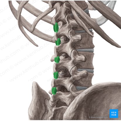Musculi interspinales lumborum (Zwischendornmuskeln der Lende); Bild: Yousun Koh