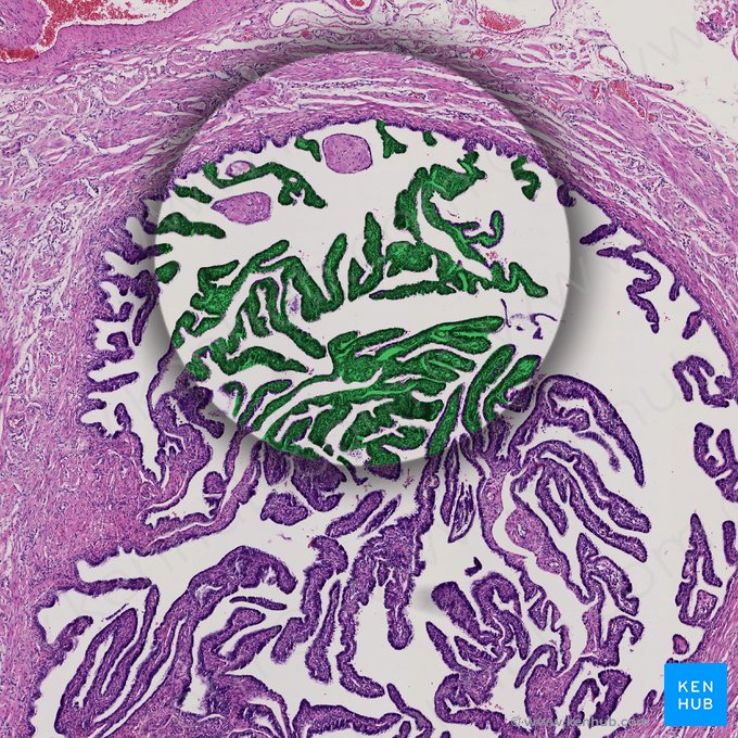 Fimbriae of uterine tube (Fimbriae tubae uterinae); Image: 