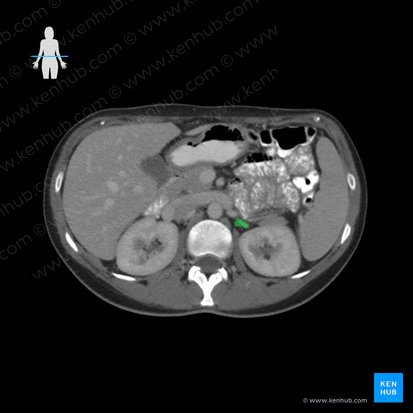 Suprarenal gland (Glandula suprarenalis); Image: 