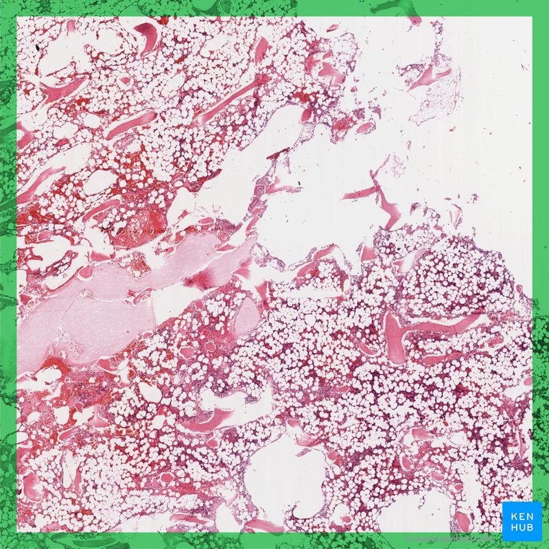 Yellow bone marrow - histological slide