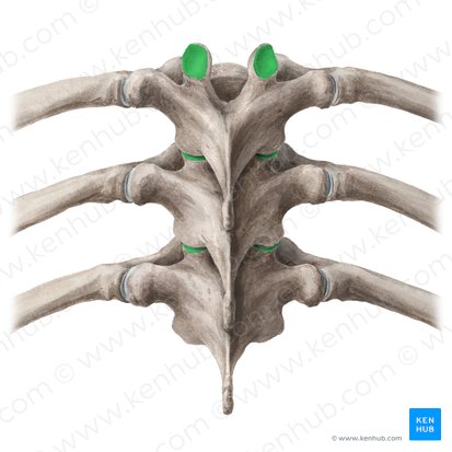 Facies articularis superior vertebrae (Obere Gelenkfläche des Wirbels); Bild: Liene Znotina