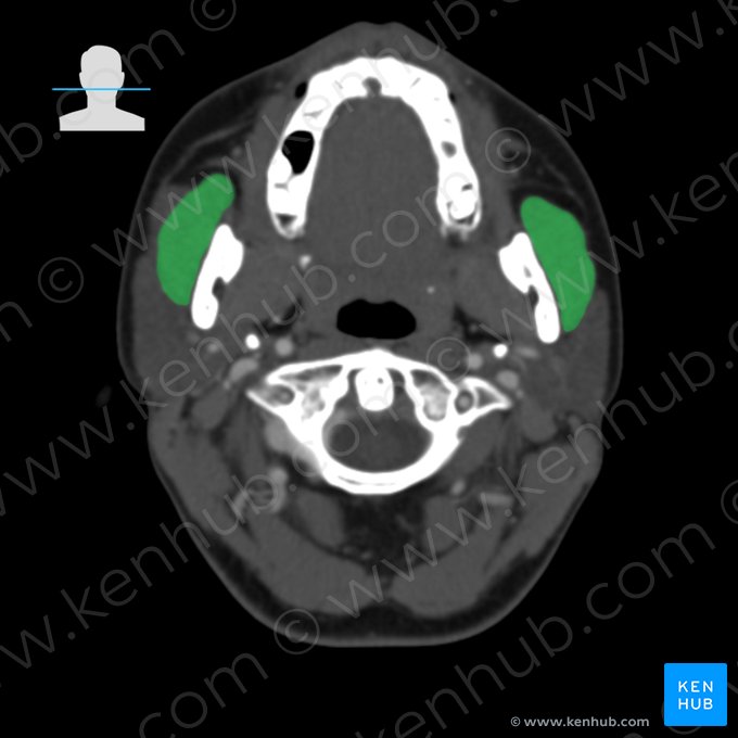 Músculo masseter (Musculus masseter); Imagem: 