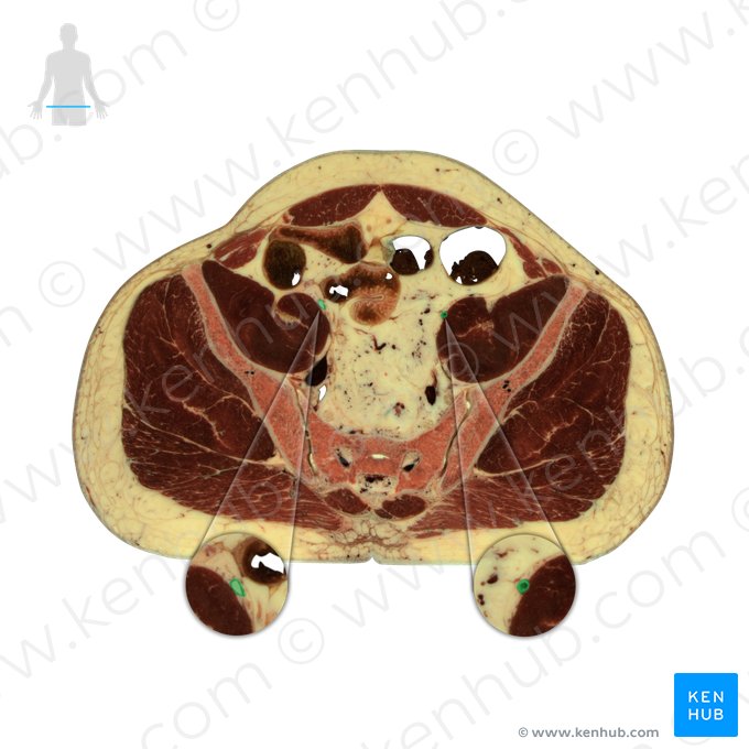 Arteria iliaca externa (Äußere Beckenarterie); Bild: National Library of Medicine