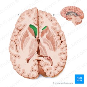 Asta frontal del ventrículo lateral (Cornu frontale ventriculi lateralis); Imagen: Paul Kim