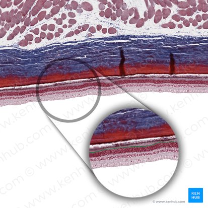 Membrana limitante externa (Stratum limitans externum retinae); Imagen: 