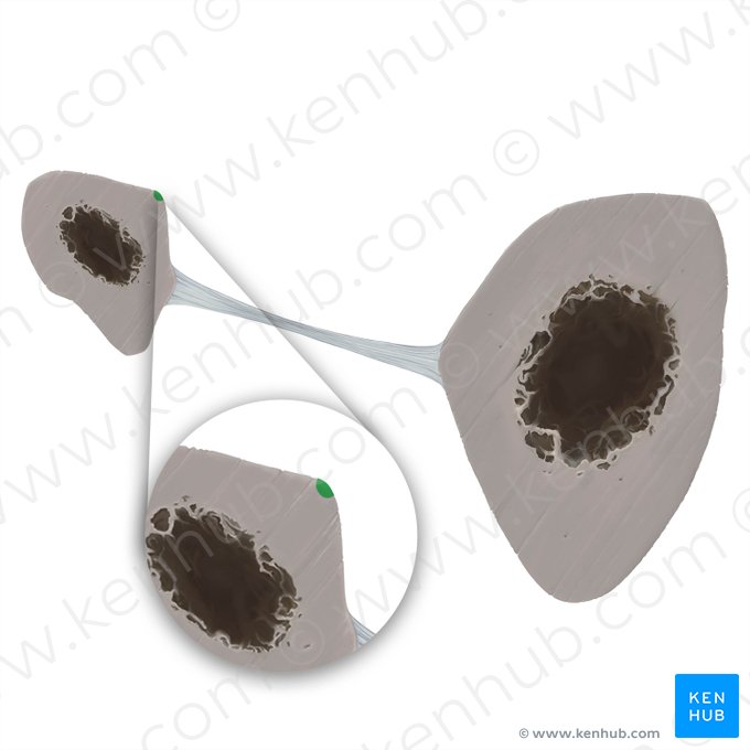 Borda medial da fíbula (Margo medialis fibulae); Imagem: Tal Bavli Ziv