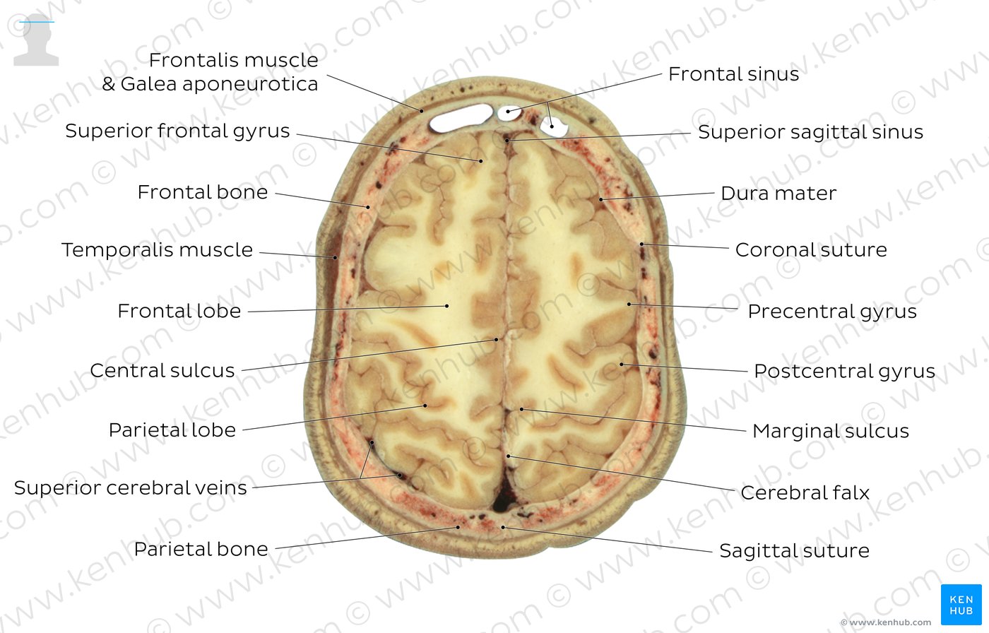 Frontal sinus level: Overview
