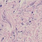 Dense connective tissue