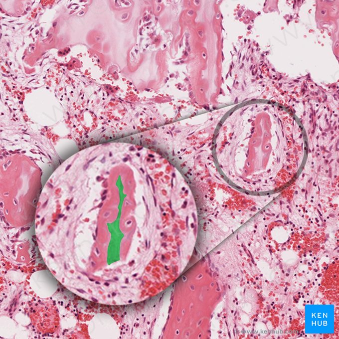 Calcified cartilage (Cartilago calcificata); Image: 