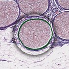 Gemischter Nerv - Histologie