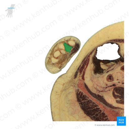 Hueso trapecio (Os trapezium); Imagen: National Library of Medicine