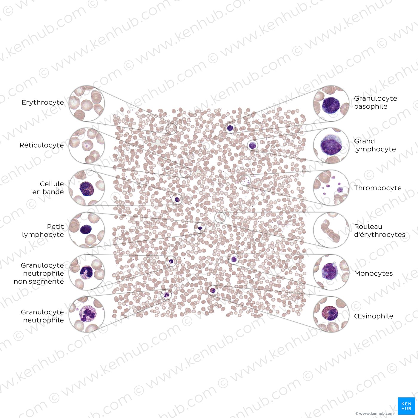Blood smear