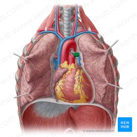Arteria pulmonalis sinistra (Linke Lungenarterie); Bild: Yousun Koh